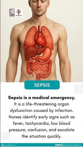 The 4 Early Signs of SEPSIS EVERY NURSE Must Know! (Critical Care Nursing Facts) | CBS