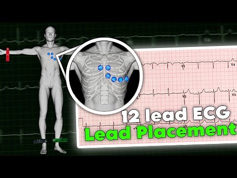 ECG lead placement MADE EASY | 12 lead ECG placement | How to perform ECG • Daily Cardiology