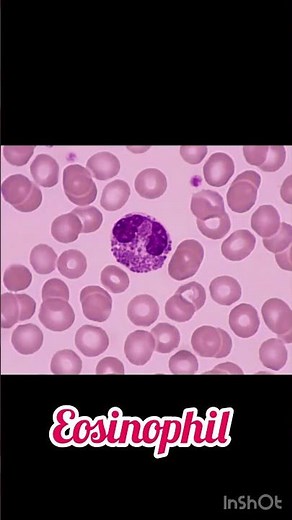 Differential leukocyte count (WBC) #dlc #microscopy #viralvideos #hematology