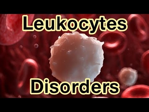 Leukocytes disorders (wbc disorders) leukopenia ' leukocytosis' leukemia ' Lymphoma