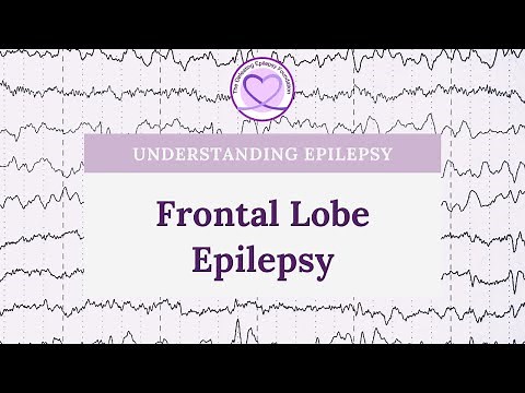 Causes, Symptoms, and Treatment for Frontal Lobe Epilepsy