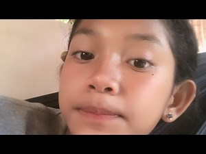 Acne Treatment Huong beauty The man