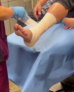 What is an Unna boot ? An UNNA boot is a type of compression bandage...