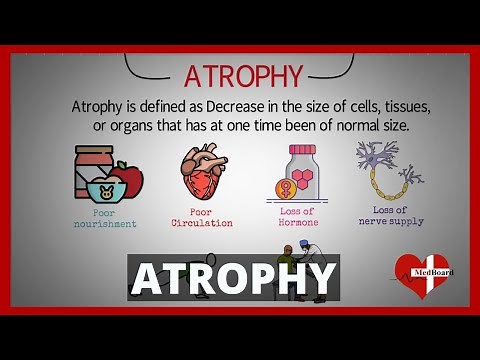 Atrophy -Types and Causes (Made Easy) | What is atrophy? |