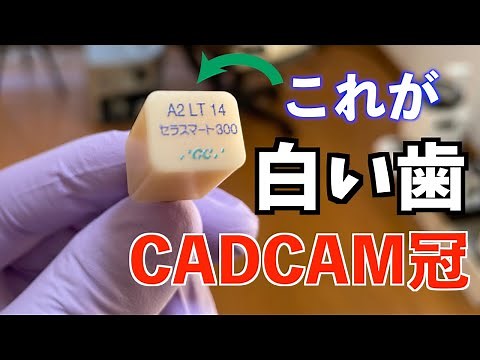保険でできる白い歯CADCAM冠の作り方