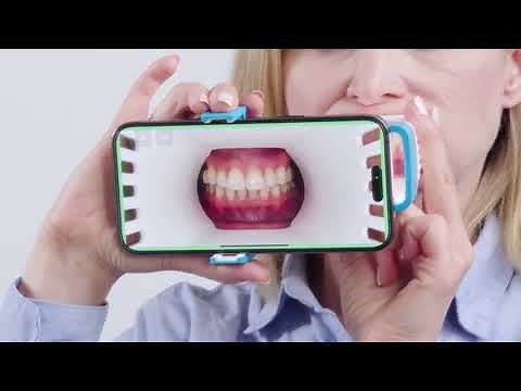 Invisalign Virtual Care