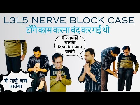 🚨 Nerve damage case L3 L5 Sciatica | unstable walk Gait | chiropractic Treatment Results