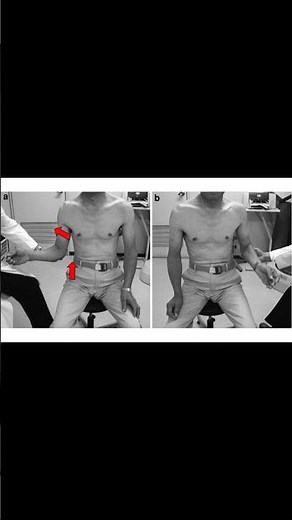 Dropping Sign Test | Shoulder Exam Explained #meded #shoulderpain #atc #physiotherapy #orthopedic