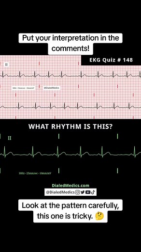 Explore EKG Rhythm Patterns for Medical Training