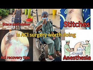 My ACL surgery honest opinion😳 ❤️‍🩹|fiber tape | detail video from day 1 to 15 recovery 👌