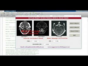 Multimodal Medical Image Fusion Using Matlab | with Source Code | Multimodal Image Fusion Code