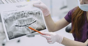 Wisdom Tooth Pain: Symptoms, Treatment and Relief - Fernvale Dental