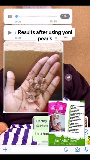 I appreciate your support & recomedations my pipo #yeastinfections #women #norahsbodyandbeautyhub