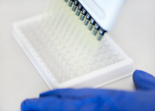 ELISA Protocol | Step-by-step instructions | Proteintech