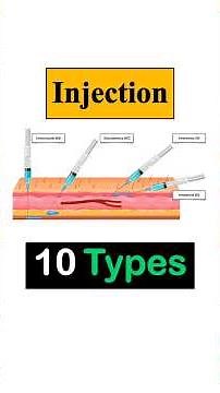 Injection 10 Types || Route of Injection || Injection Techniques #Nursing #dmlt #bmlt #medical