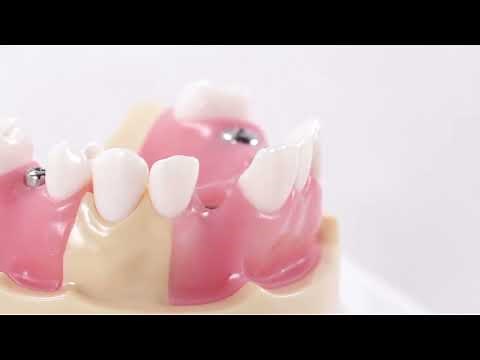 Dentium USA Bone-Level Implant Impression Step By Step Demonstration (Closed Tray Technique)