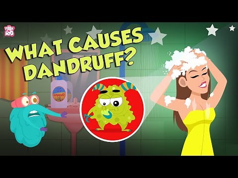 What Causes Dandruff? | How To Treat Dandruff? | The Dr Binocs Show | Peekaboo Kidz