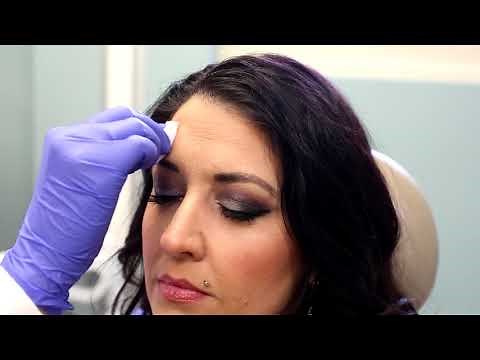 Carilion Cosmetic Center Botox Before and After