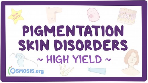 Pigmentation skin disorders: Pathology review: Video, Causes, & Meaning | Osmosis