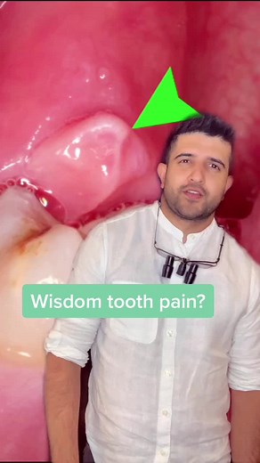 Wisdom Tooth Pain Relief Tips and Tricks