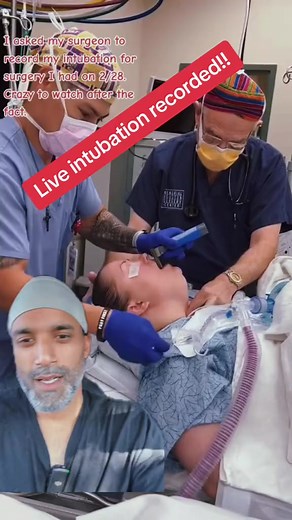 1.9M views · 69K reactions | Actual intubation and placement of a ventilator. #anesthesia #surgery #ventilator #lifesupport | Zain Hasan | Facebook
