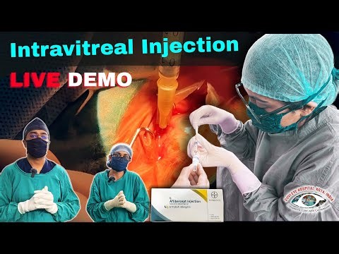 Live Intravitreal Aflibercept Injection on Submacular Hemorrhage Patient – Full Procedure