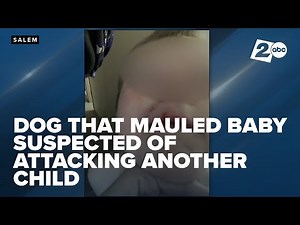 Salem Dog owner accused in toddler's mauling had another similar animal control case