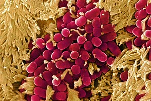 What You Should Know About E. Coli