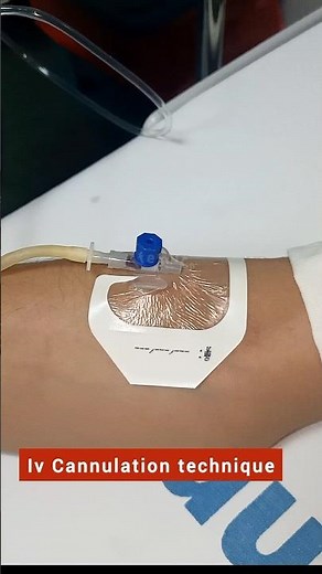 IV cannulation technique || Intravenous cannulation || Cannula