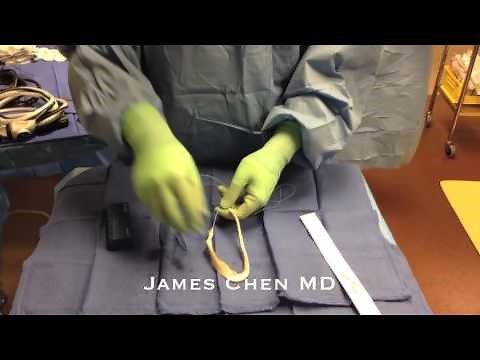 ACL Cadaver Allograft Preparation