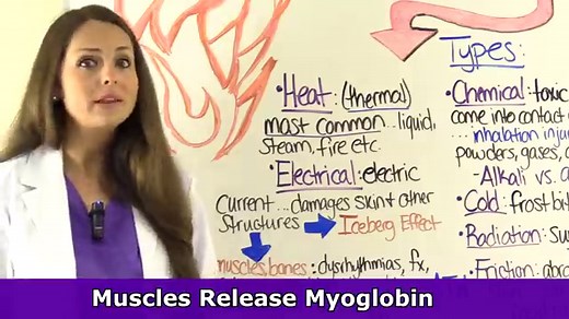 Burns NCLEX Questions