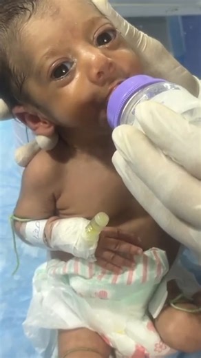 53K views · 926 reactions | How to Give Formula Feeding in NICU Step by Step | Doctor Give birth | Facebook