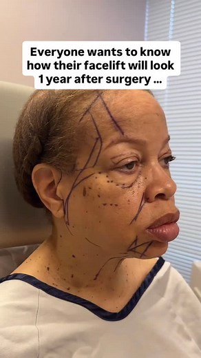 1.4K views · 51 reactions | One of my most frequently asked...