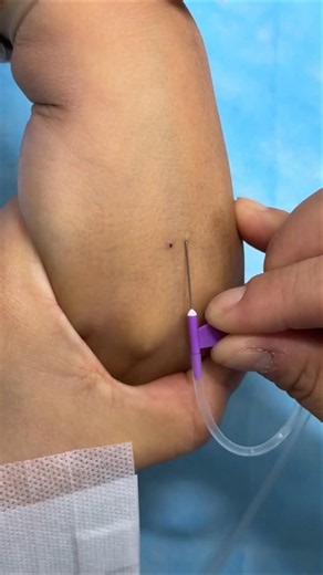 Injection Technique Made Simple | Types of Needle Injections You Need To Know Class 50