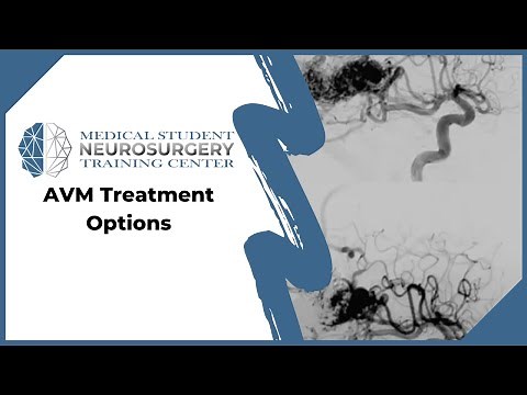 AVM Treatment Options