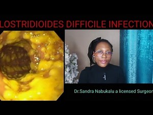 Understanding Clostridioides difficile Infection: Causes, Symptoms, Treatment & Prevention.