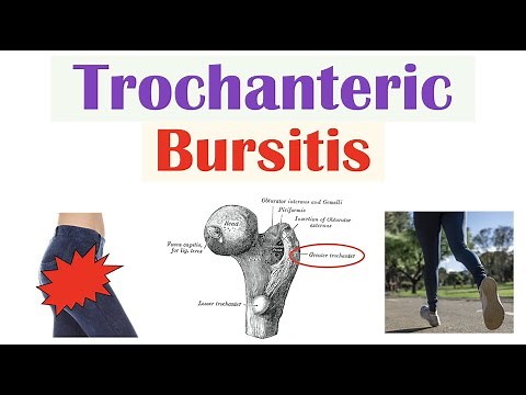 Trochanteric Bursitis (Greater Trochanteric Pain Syndrome) | Causes, Symptoms, Diagnosis, Treatment