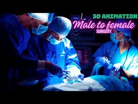 Understanding Male to Female Gender Confirmation Surgery: A 3D Animation