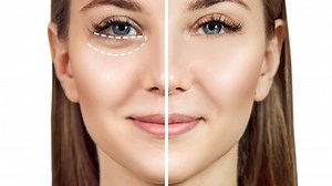 How to Get Rid of Under Eye Bags Naturally and Permanently