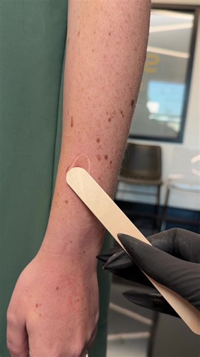 Tiny paw print freckle tattoos done for my client Stephanie ♡ @syzygy tattooing #tattoo #tattooartist #finelinetattoo #tattooplacement #tinytattoo