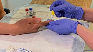 New syphilis rapid test could slow disease’s spread, doctors say