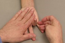 Trigger Finger - Trigger Thumb - OrthoInfo - AAOS