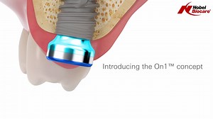 6.4K views · 42 reactions | Check out the new innovative On1 concept....