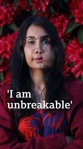 380K views · 6K reactions | “I always say I am unbreakable.” Shakila Zareen was forced into child marriage and then shot in the face by her husband. Now she is using her voice to advocate for other Afghan women. https://bbc.in/3AMhYNb | BBC News | Facebook