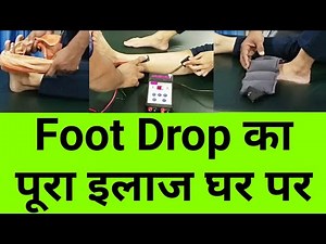 complete foot drop treatment at home - exercises , massage , electric stimulation - Physiotherapy
