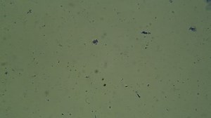 「Microscope View Bacteria Prokaryotic Cells」の動画素材（ロイヤリティフリー）1008002143 | Shutterstock