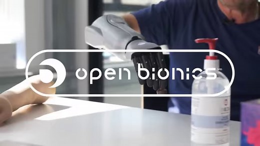 2K views · 76 reactions | Hero Arm – a prosthetic arm for adults and...