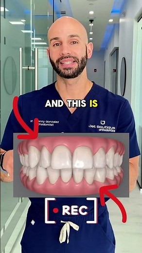 Invisalign before and after example