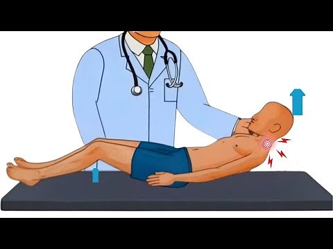 3 Meningitis Tests: Nuchal Rigidity, Kernig's & Brudzinski's Signs Explained!