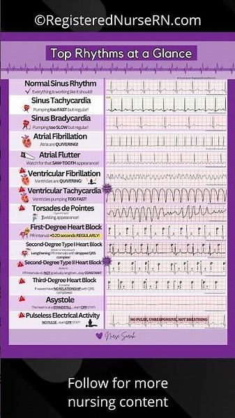 ECG Rhythms Made Easy Nursing NCLEX Cheat Sheet #nurse #shorts